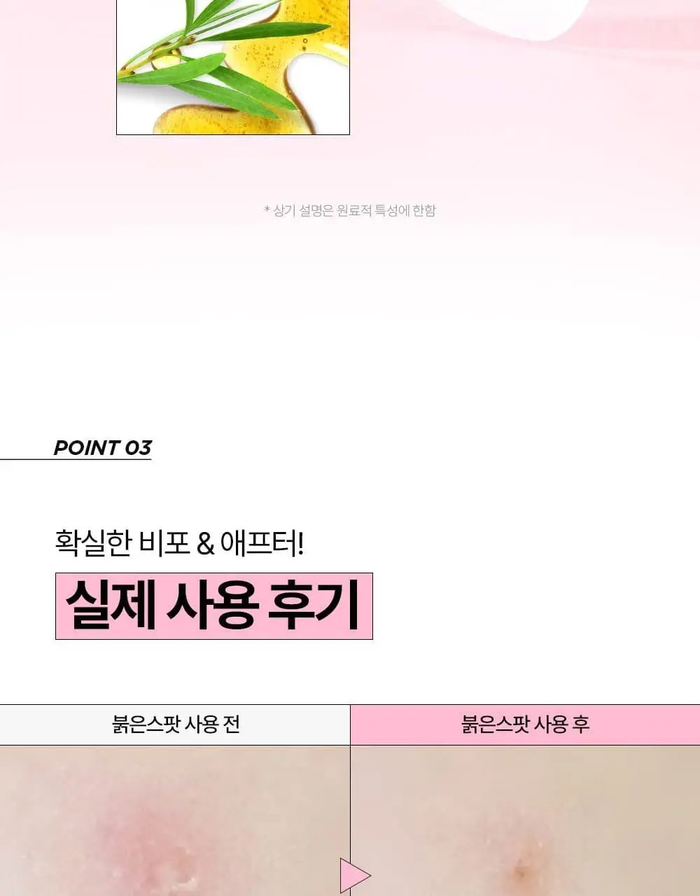 [올영단독기획 / 짜기 전/후 구성] 해서린 스팟케어 패치 키트 대용량 기획 140매 상세페이지 23